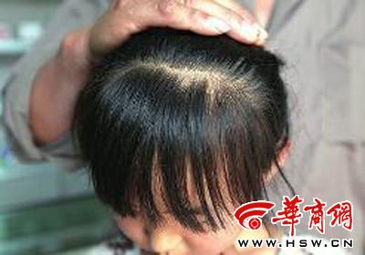 　8歲的嘟嘟在爺爺懷中顯得特別害怕，3個月前被老師揪掉的頭發(fā)至今沒有長出 本報(bào)記者 趙釗 攝