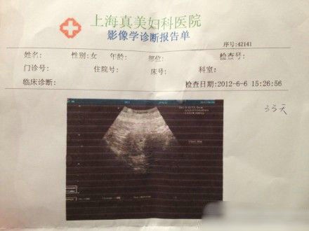 袁莉老公曝妻懷孕一月,曬其B超照。
