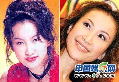 一線(xiàn)女星豪門(mén)臉整容內(nèi)幕