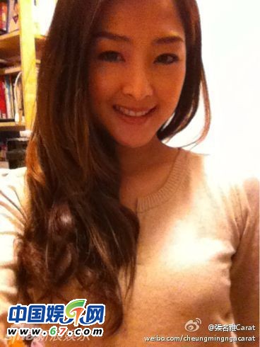 有人爆料指張名雅做過(guò)四次整形手術(shù)，還提供了一張疑似張名雅的舊照(左圖)