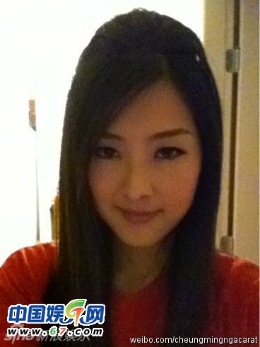 有人爆料指張名雅做過(guò)四次整形手術(shù)，還提供了一張疑似張名雅的舊照(左圖)