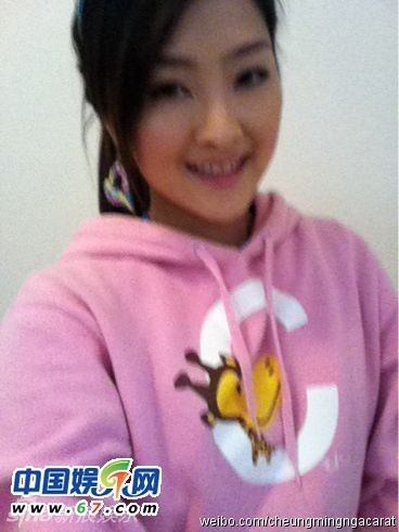 有人爆料指張名雅做過四次整形手術，還提供了一張疑似張名雅的舊照(左圖)