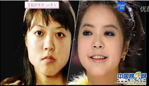 多圖劇透韓國整容節(jié)目《LET 美人》近幾期，最愛小V臉，人瘦就能美