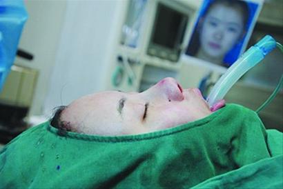 妙齡女沒當(dāng)上空姐發(fā)誓整容 砸15萬(wàn)挨11刀